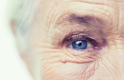 Eye